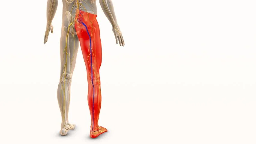 sciatica pain